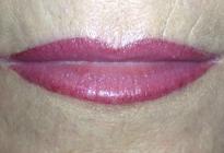 images/Letzte-Arbeiten/lippen//Lippe-Rosi-nachher.jpg