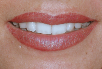 images/Letzte-Arbeiten/lippen//Lippen.png