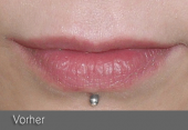 images/Referenzen/lippen/Foto_B_5.png