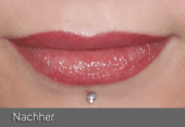 images/Referenzen/lippen/Foto_B_6.png