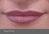 images/Referenzen/lippen/Foto_C_2.png
